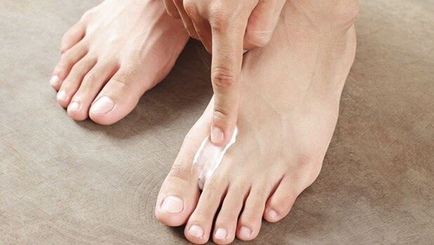 Instrucións para o uso da crema Marn exodermin MAND contra o fungo para un bo resultado